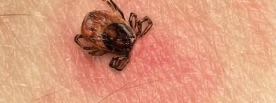 加拿大发现一种由蜱虫传播的罕见致命疾病：安省魁省都有