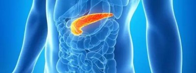 新药物组合可“饿死”胰腺癌：阻止癌细胞获得燃料