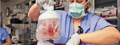 全球首例 62歲患者被植入豬腎臟