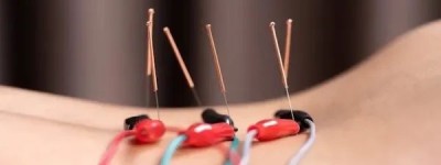 72岁华裔针灸师性侵病人，受害者“浑身是针、如同被囚”！