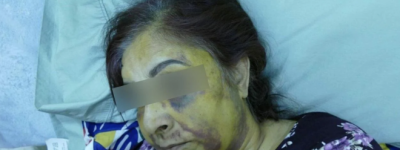 旺市入室抢劫案：警方罕见地公开了受害者遭袭击后惨状