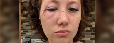 吓人！魁省惊现多起迷药案，女子节庆活动上一杯饮料下肚立马瘫软