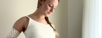 患罕见病几乎无法吃饭：加拿大女子自费寻求到国外接受手术