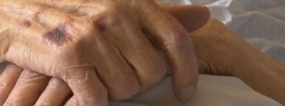 妻患老年痴呆，BC男子多次计划杀妻再自杀