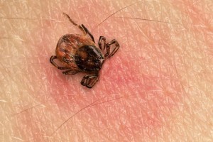 加拿大发现一种由蜱虫传播的罕见致命疾病：安省魁省都有