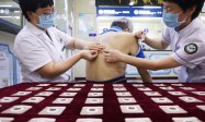 三伏貼，別亂貼！醫生提醒：這7類人不適合