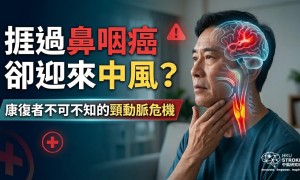 捱過鼻咽癌卻迎來中風？ 康復者不可不知的頸動脈危機